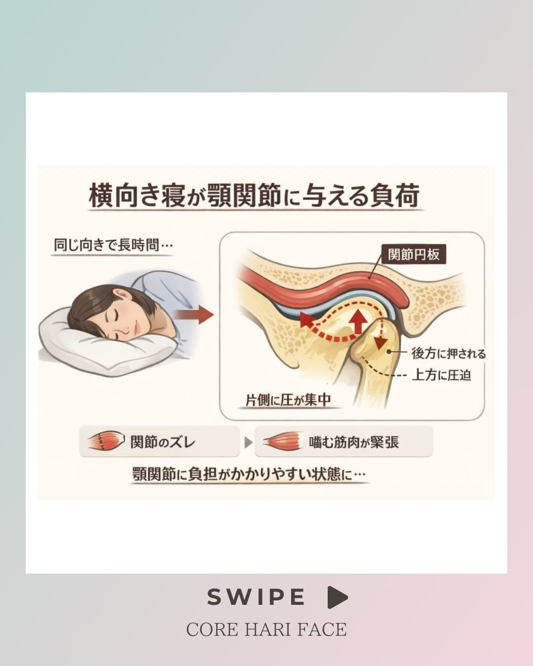 「横向き寝＝顎関節が歪む」かも！